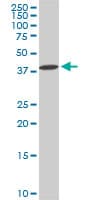 Monoclonal Mouse anti-Human DCPS Antibody (clone 1G4, IHC, IF, WB)