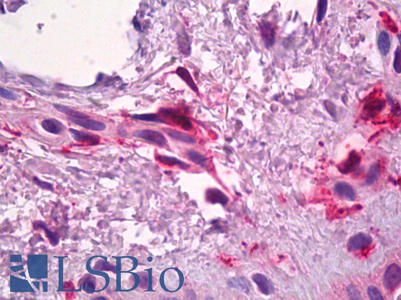 IHC-plus™ Polyclonal Goat anti-Human F13A1 / Factor XIIIa Antibody (IHC)