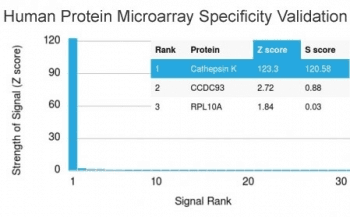 CTSK / Cathepsin K Antibody (clone CTSK/2791)