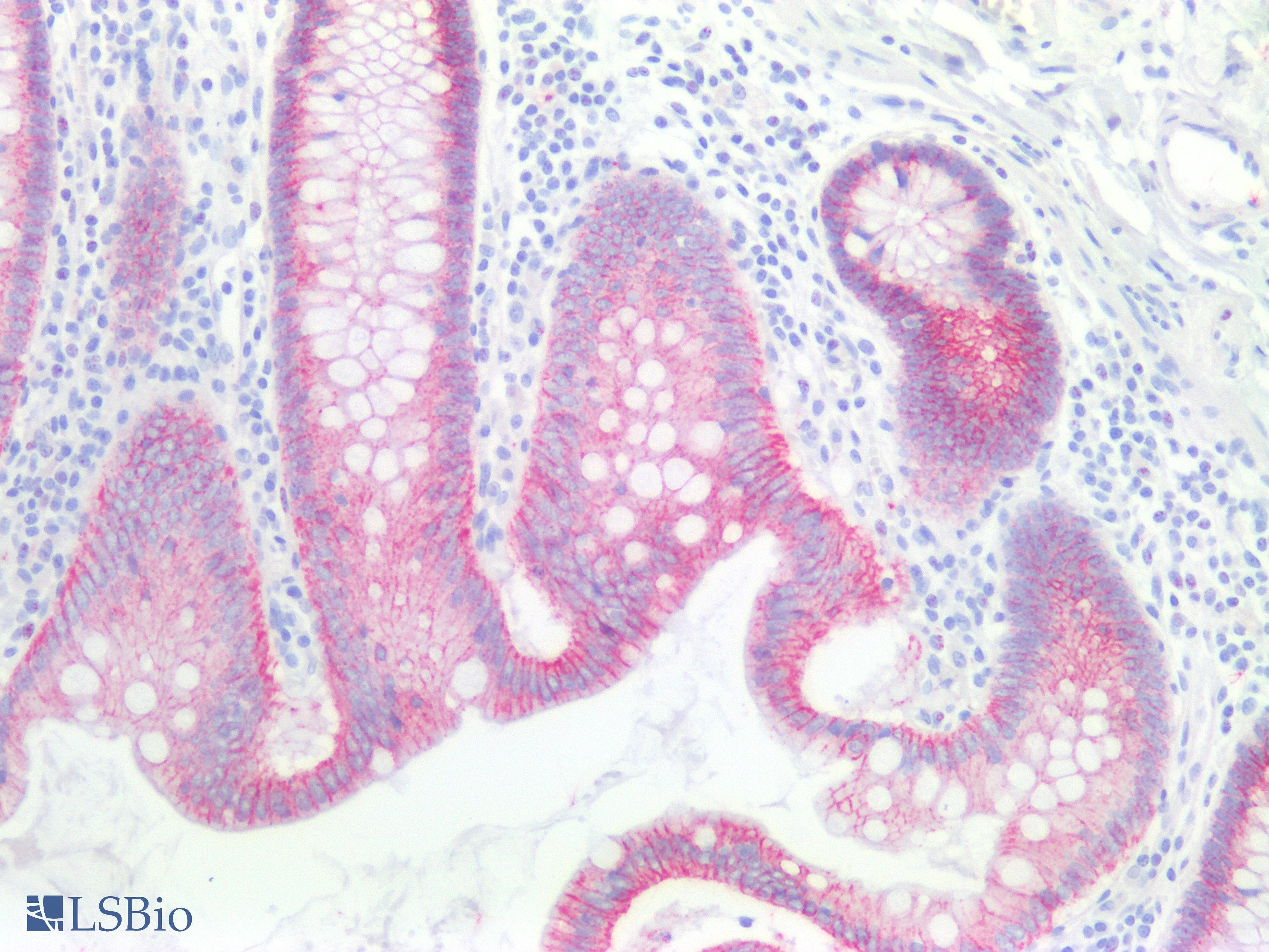 PathPlus™ CTNNB1 / Beta Catenin Antibody (C-Terminus)