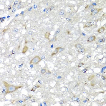 Polyclonal Rabbit anti-Human CBR3 Antibody (IHC, IF, WB)