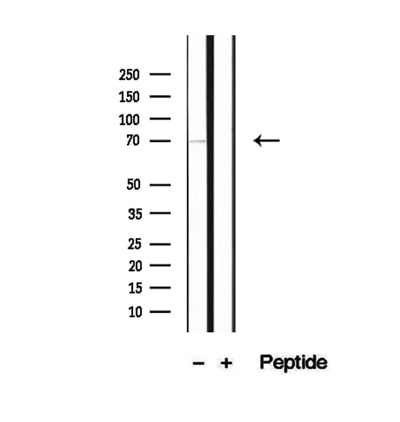 PCCA Antibody