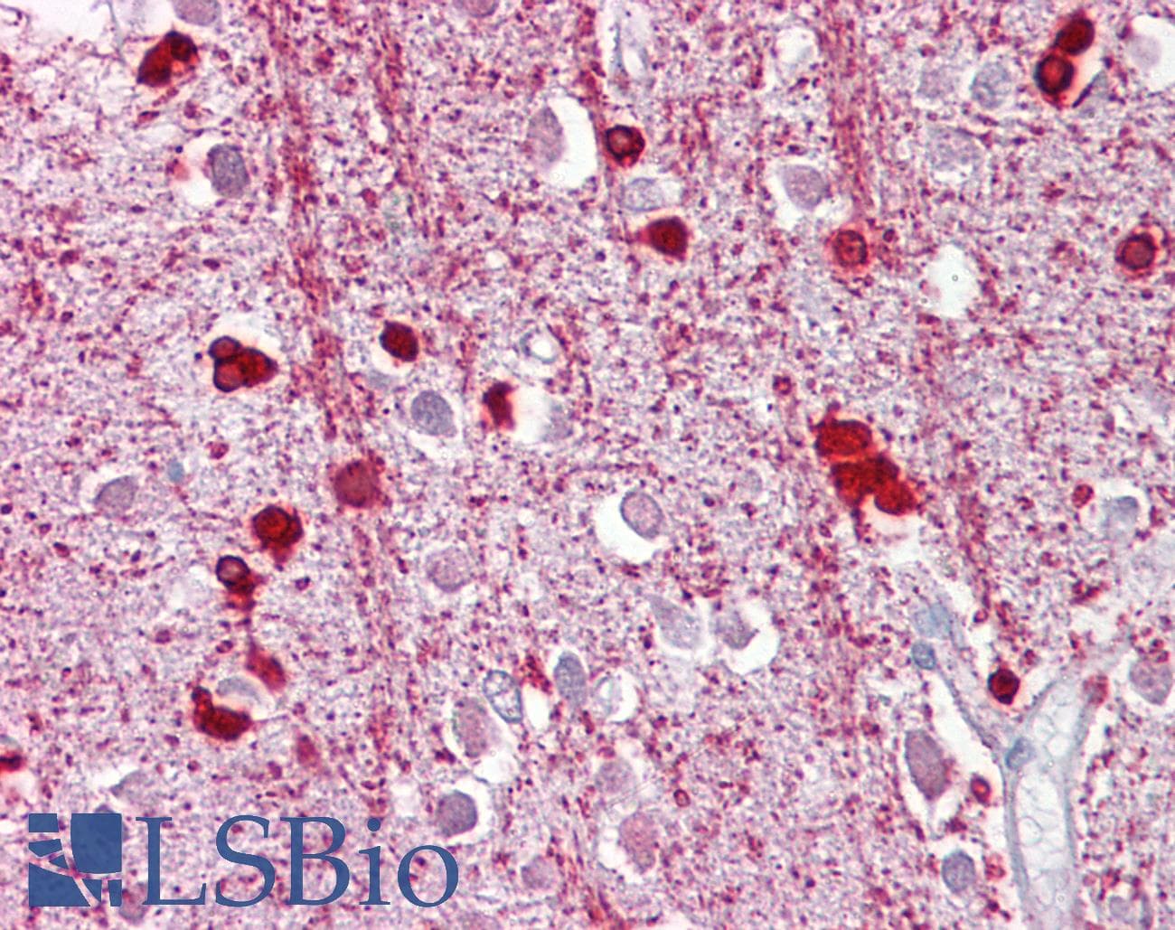 ZEB2 / SIP-1 Antibody (aa36-85)