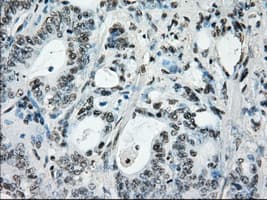 Monoclonal Mouse anti-Human BRAF / B-Raf Antibody (clone OTI4G6, IHC, WB)