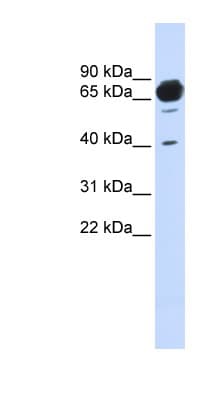 Polyclonal Rabbit anti-Human MAN1A2 Antibody (aa468-517, WB)