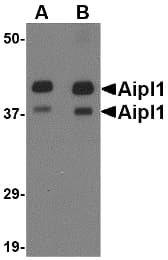 IHC-plus™ Polyclonal Rabbit anti-Human AIPL1 Antibody (IHC, IF, WB)