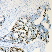 Polyclonal Rabbit anti-Human AR / Androgen Receptor Antibody (phospho-Ser650, IHC, WB)