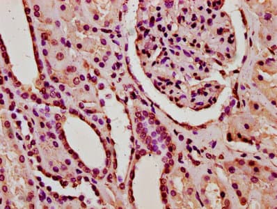 HIST1H2BN Antibody