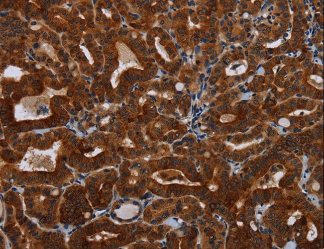 KLHL1 Antibody