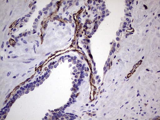 PECAM-1 / CD31 Antibody (clone UMAB164)