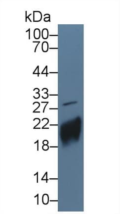CGB / hCG Beta Antibody (aa31-165, Biotin)