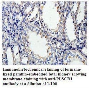 Polyclonal Rabbit anti-Human Scramblase / PLSCR1 Antibody (aa134-300, IHC, WB)