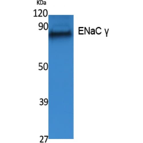 Polyclonal Rabbit anti-Human SCNN1G / ENaC Gamma Antibody (Internal, WB)