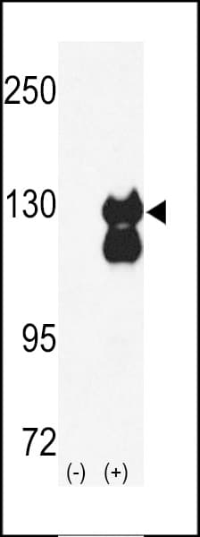 Polyclonal Rabbit anti-Human RENT1 / UPF1 Antibody (aa7-37, WB)