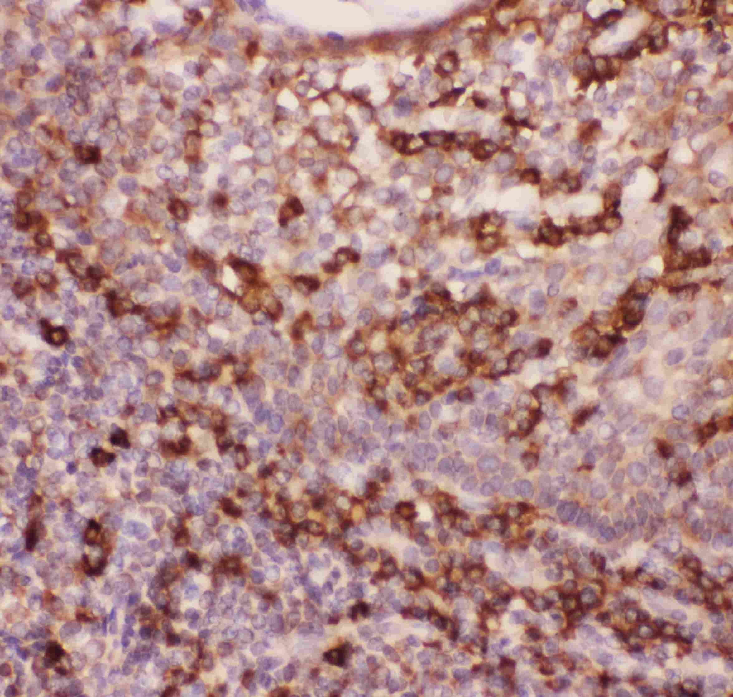 ITGAM / CD11b Antibody (aa17-382)