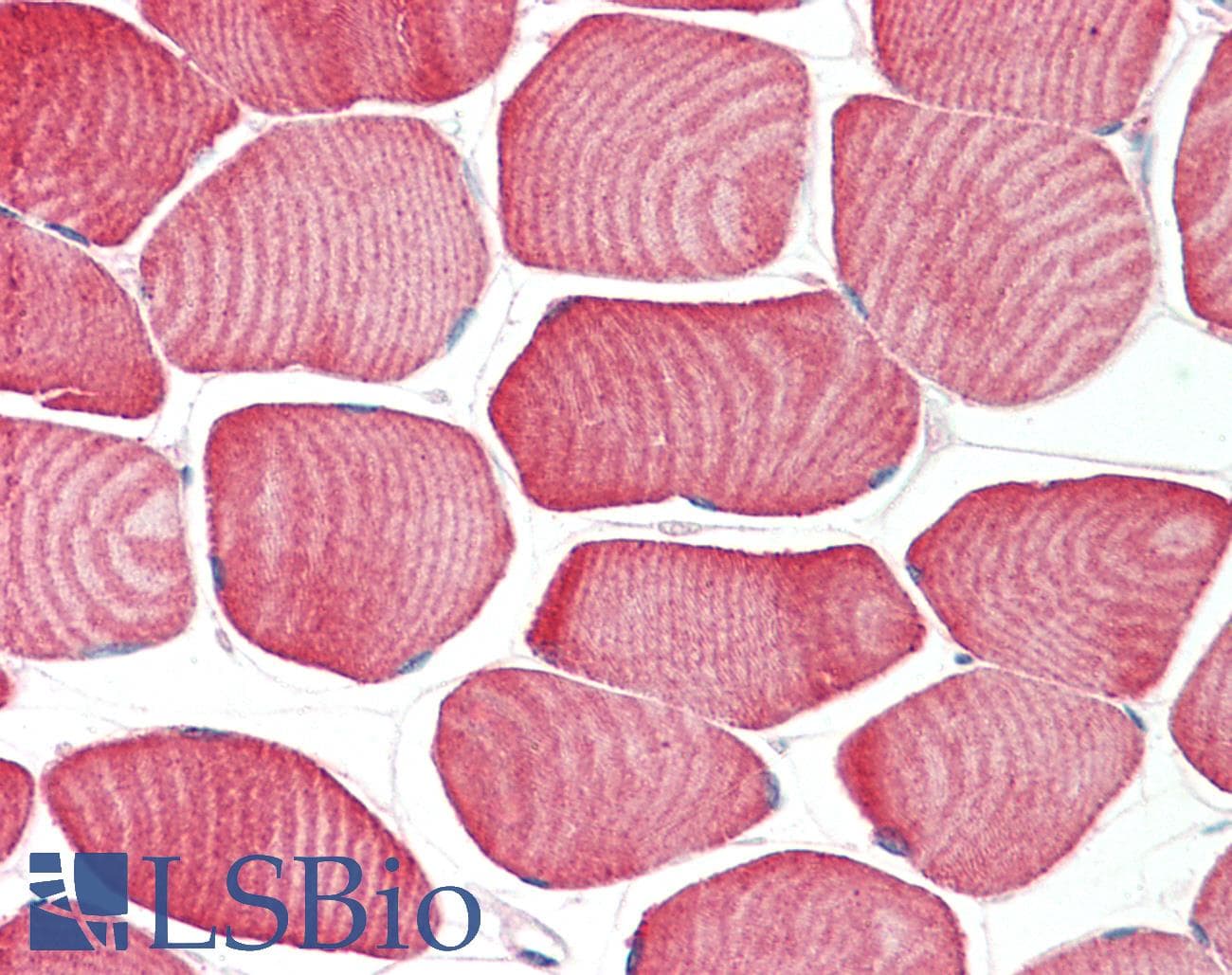 Polyclonal Rabbit anti-Human FBXO32 / Fbx32 Antibody (C-Terminus, IHC, WB)