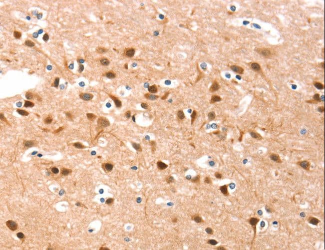 DSC1 / Desmocollin 1 Antibody