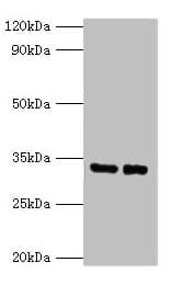 Polyclonal Rabbit anti-Human SRM / Spermidine Synthase Antibody (IHC, WB)
