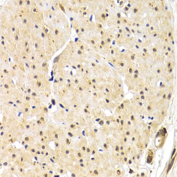 Polyclonal Rabbit anti-Human TRF1 / TERF1 Antibody (IHC, WB)