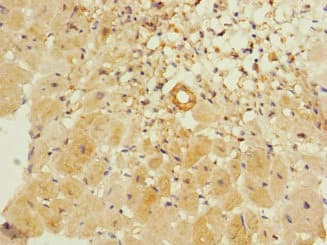 ITGA11 / Integrin Alpha 11 Antibody
