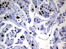 Monoclonal Mouse anti-Human MKI67 / Ki67 Antibody (clone OTI3B6, IHC)