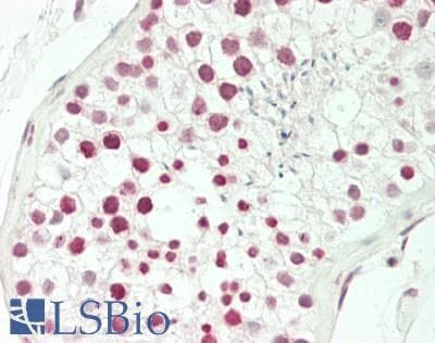 IHC-plus™ AURKC / Aurora C Antibody (aa1-30)