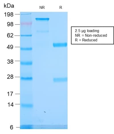 SPTA1 / Alpha Spectrin Antibody (aa356-475, clone SPTA1/2939R)