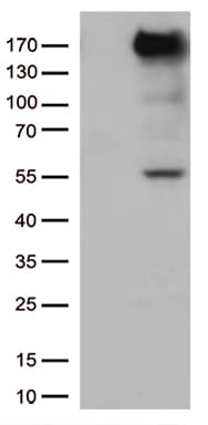 XDH / Xanthine Oxidase Antibody (aa1-280, clone OTI5D8)