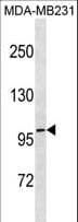 TCHHL1 Antibody (aa185-211)