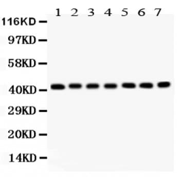 ACTA1 / Skeletal Muscle Actin Antibody (aa359-377)