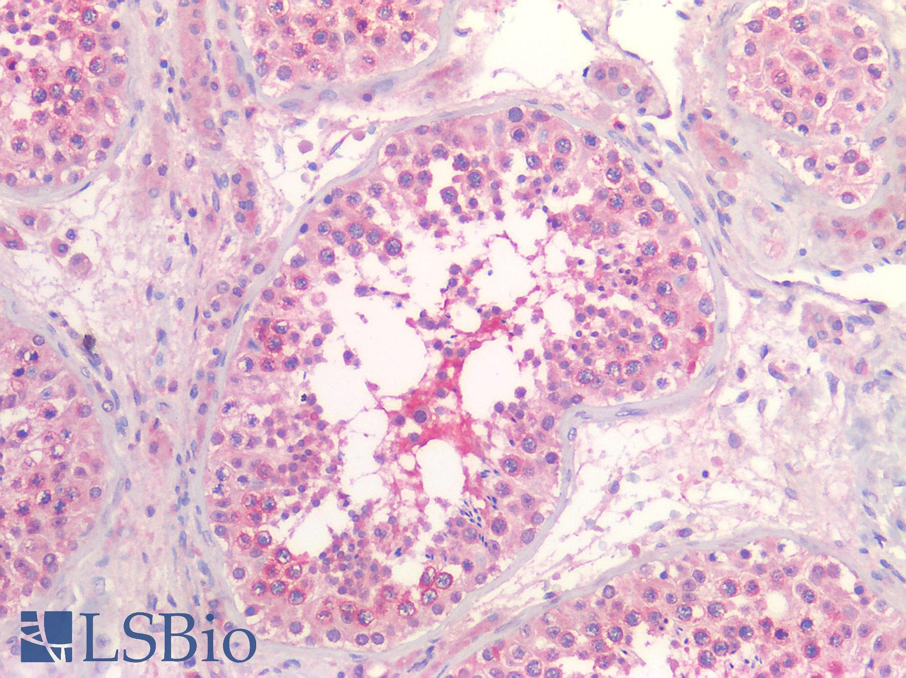IHC-plus™ HDAC6 Antibody