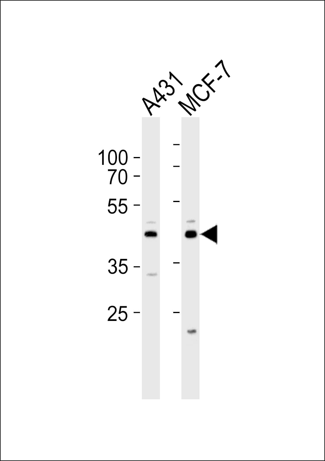 IDH3G Antibody (aa50-83)