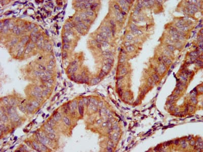 Polyclonal Rabbit anti-Human GJD2 / CX36 / Connexin 36 Antibody (IHC, WB)