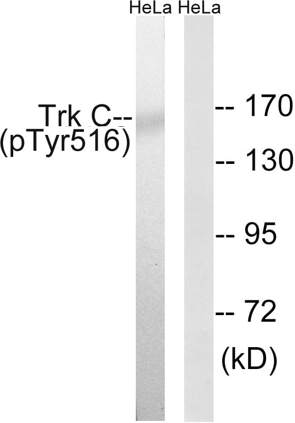 NTRK3 / TRKC Antibody (phospho-Tyr516)