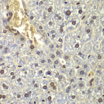 RPL5 / Ribosomal Protein L5 Antibody