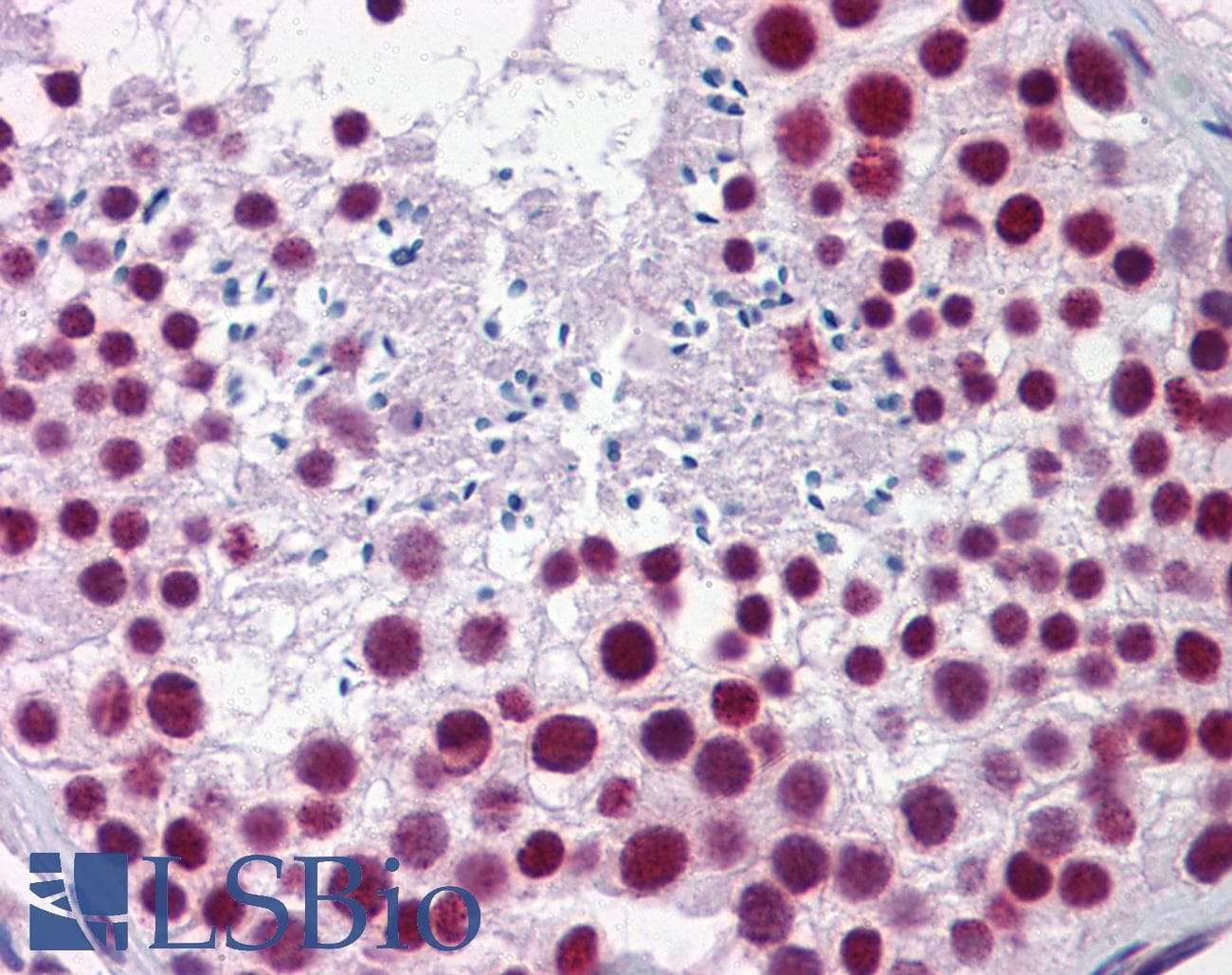 HNRNPH1 / hnRNP H Antibody (aa360-409)