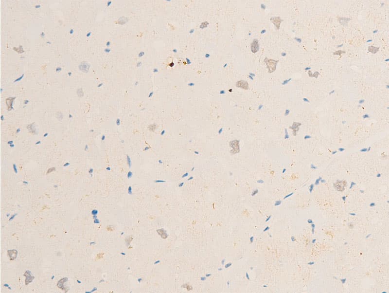Polyclonal Rabbit anti-Human SYK Antibody (phospho-Tyr323, IHC, IF, WB)