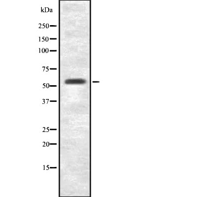 FZD7 / Frizzled 7 Antibody