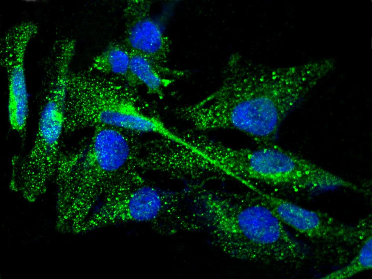 Polyclonal Rabbit anti-Human TPO / Thyroid Peroxidase Antibody (Preservative Free, IHC, IF, WB)