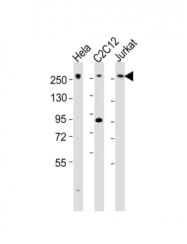 MED12 Antibody (aa1991-2025)
