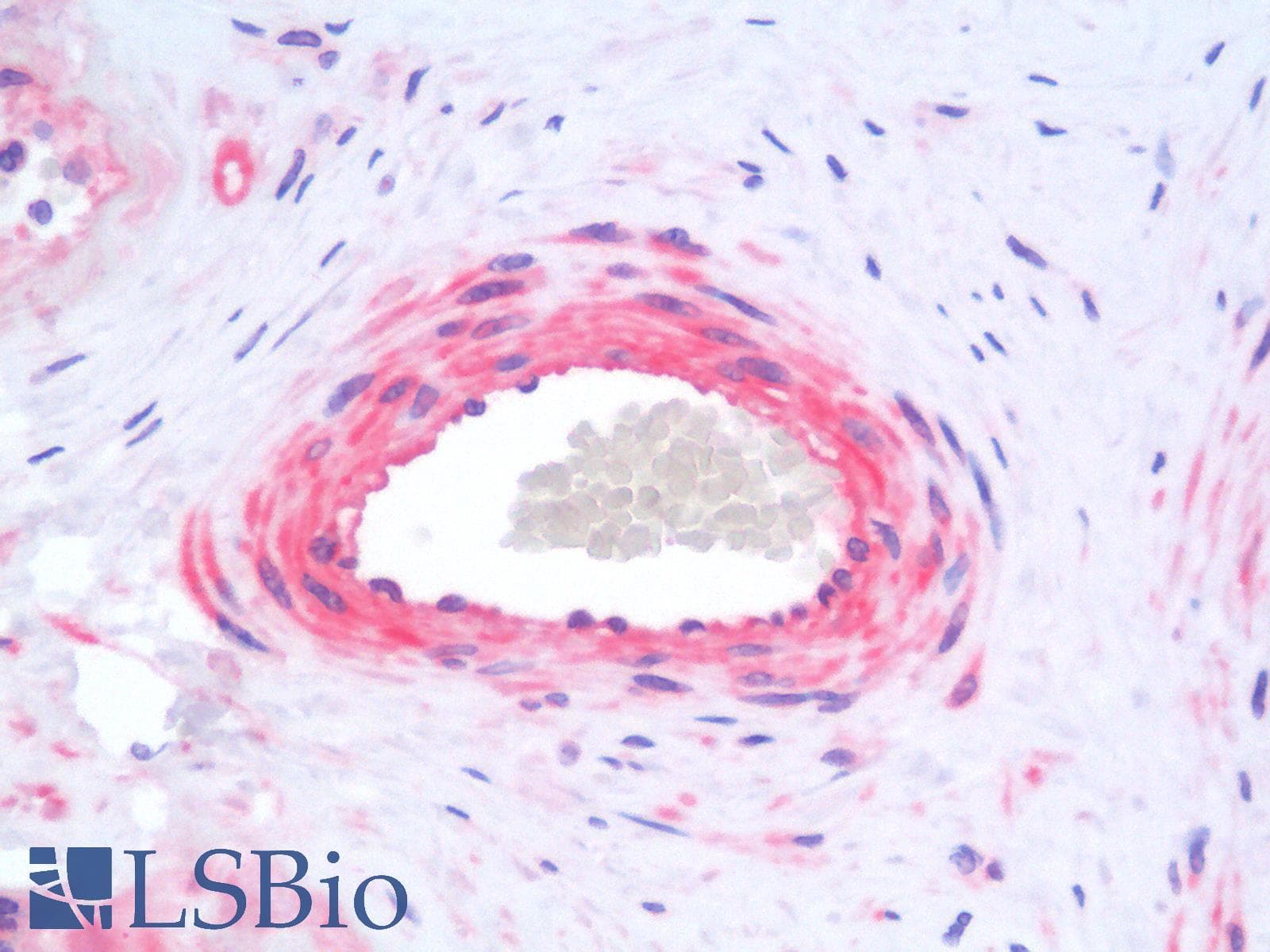 PathPlus™ Polyclonal Rabbit anti-Human SIAH2 Antibody (aa216-244, IHC, WB)