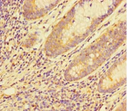 Polyclonal Rabbit anti-Human MED20 Antibody (IHC, IF)