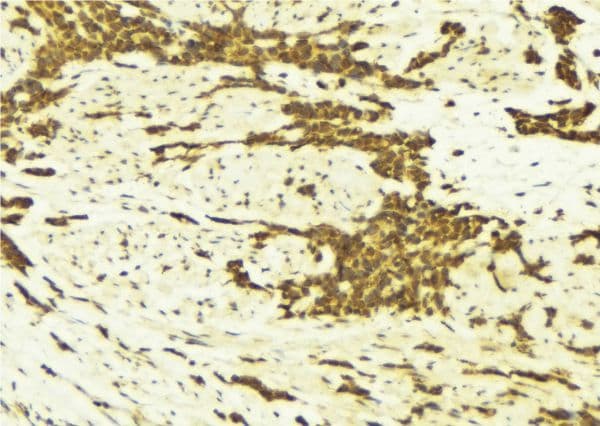 ATF1 Antibody