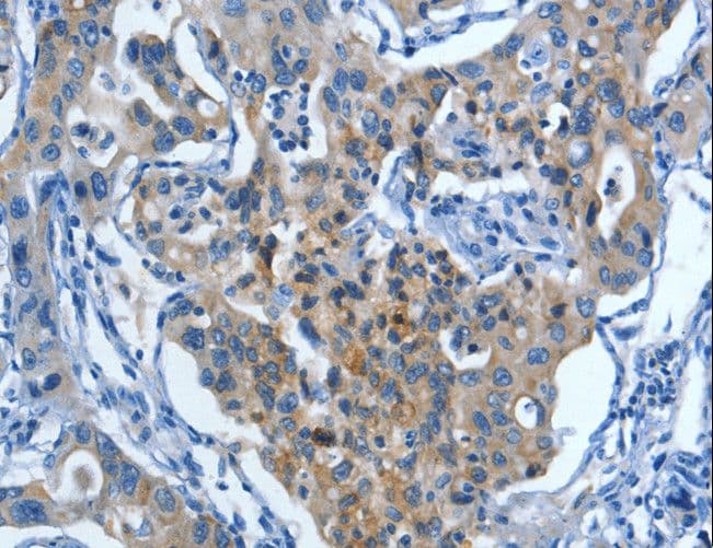 Polyclonal Rabbit anti-Human MUC15 Antibody (IHC)