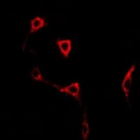 Polyclonal Rabbit anti-Human GRIK2 / GLUR6 Antibody (IF, WB)