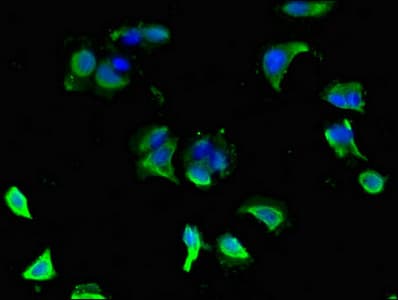 GLRA1/Glycine Receptor Alpha 1 Antibody
