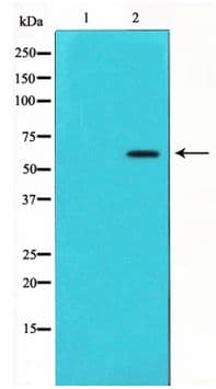 SQSTM1 Antibody