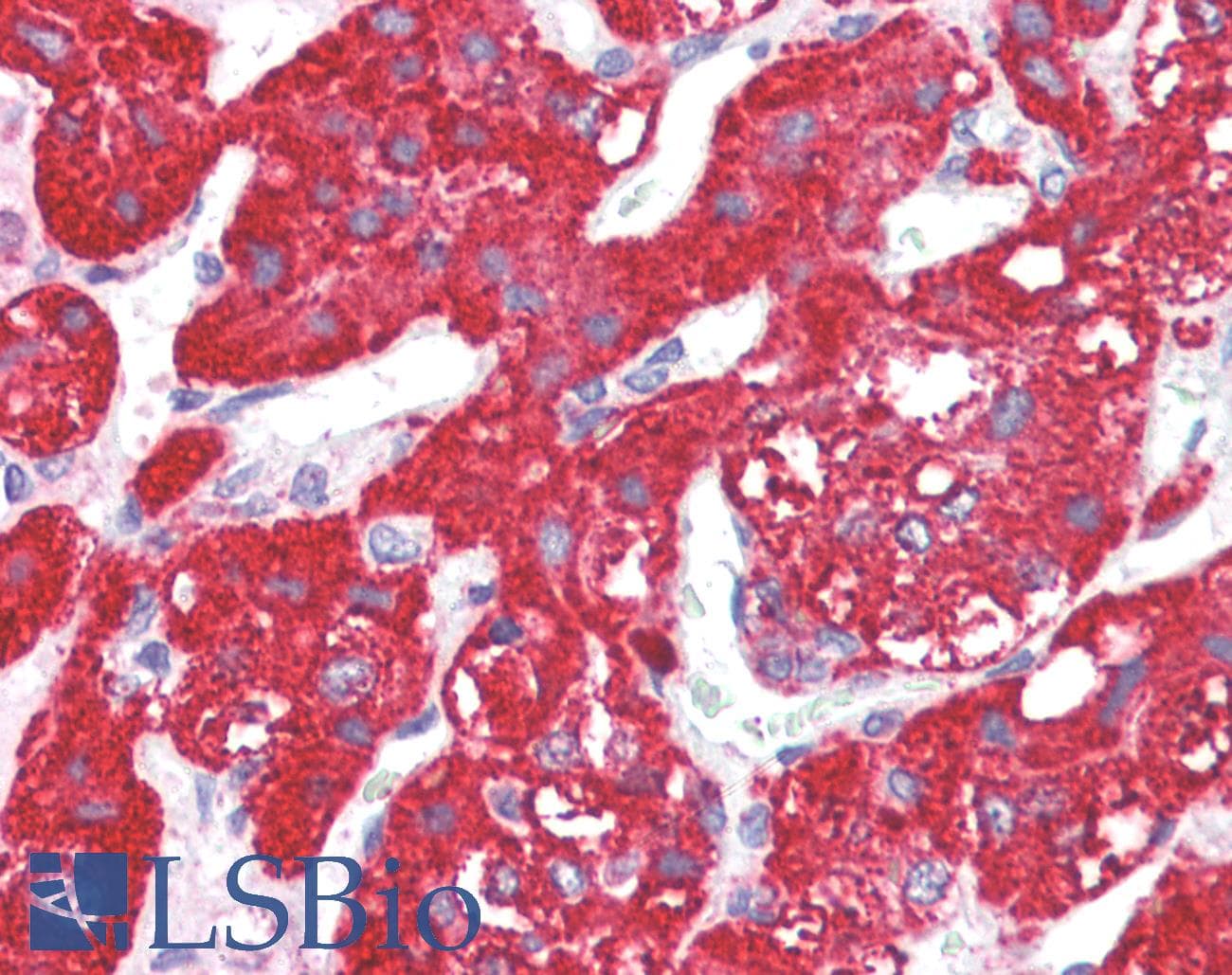 IHC-plus™ ACVR1C / ALK7 Antibody