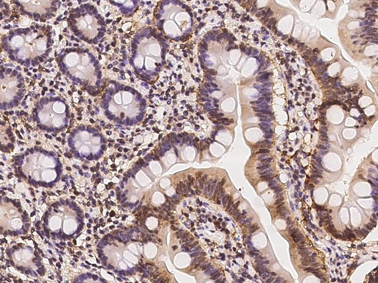 AGER / RAGE Antibody