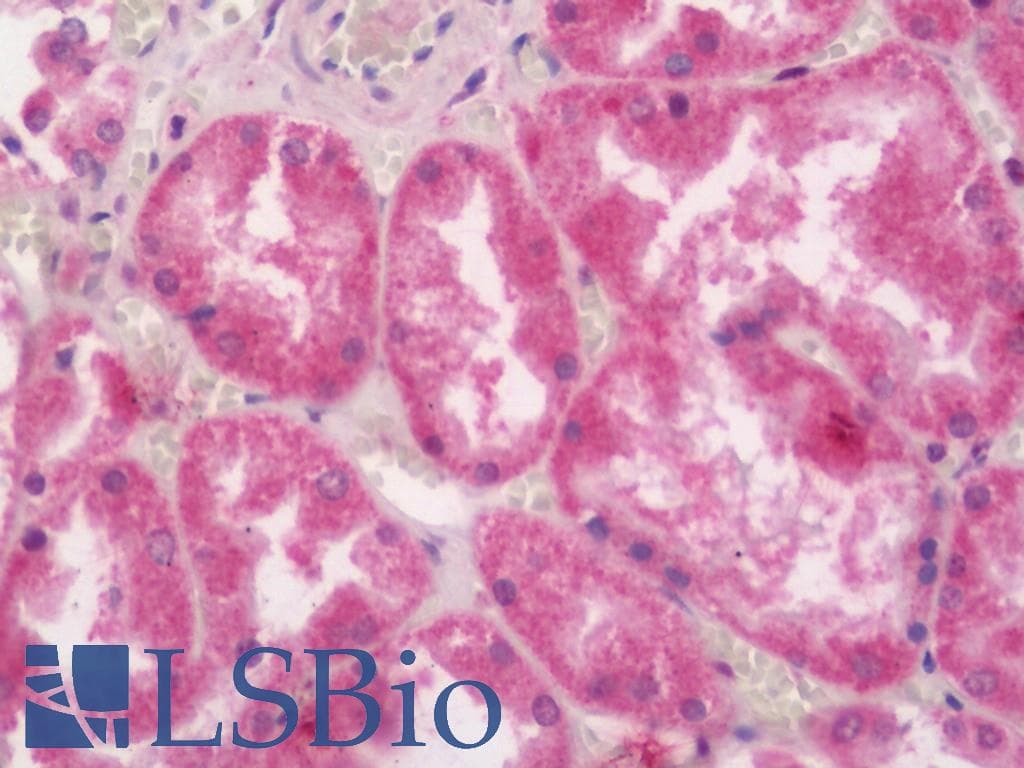 IHC-plus™ Polyclonal Rabbit anti-Human EDA / Ectodysplasin A Antibody (IHC, IF, WB)